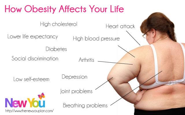 THE NEGATIVE EFFECTS OF OBESITY ON YOUR HEALTH AND YOUR LIFE