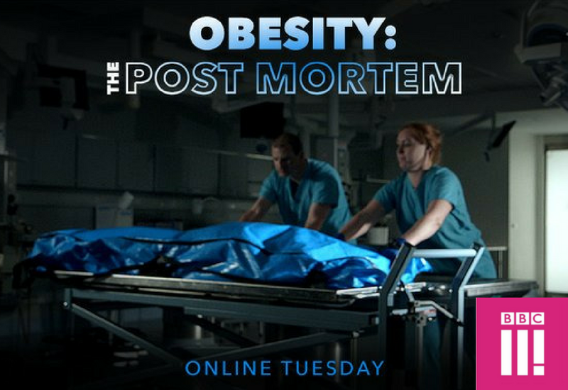 OMG What Did I Just Watch? (Traumatised): Watch The Documentary “Obesity: The Post Mortem?” NOW