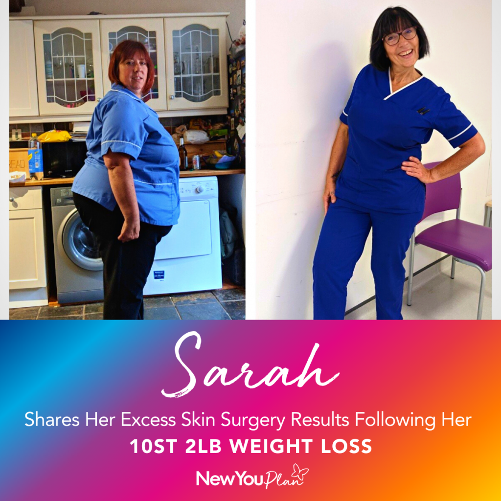 Sarah Shares Her Excess Skin Surgery Results Following Her 10st 2lb Weight Loss